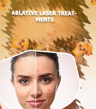 Skin treatment for face